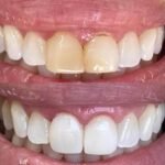 Ortocenter_Tratamento-01