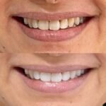 Ortocenter_Tratamento-08