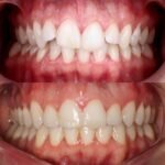 Ortocenter_Tratamento-10