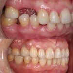Ortocenter_Tratamento-11