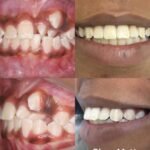 Ortocenter_Tratamento-12