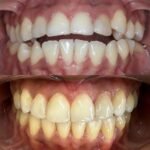 Ortocenter_Tratamento-13
