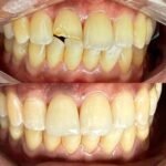 Ortocenter_Tratamento-14