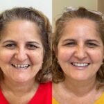 Ortocenter_Tratamento-15