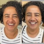 Ortocenter_Tratamento-16