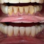Ortocenter_Tratamento-19
